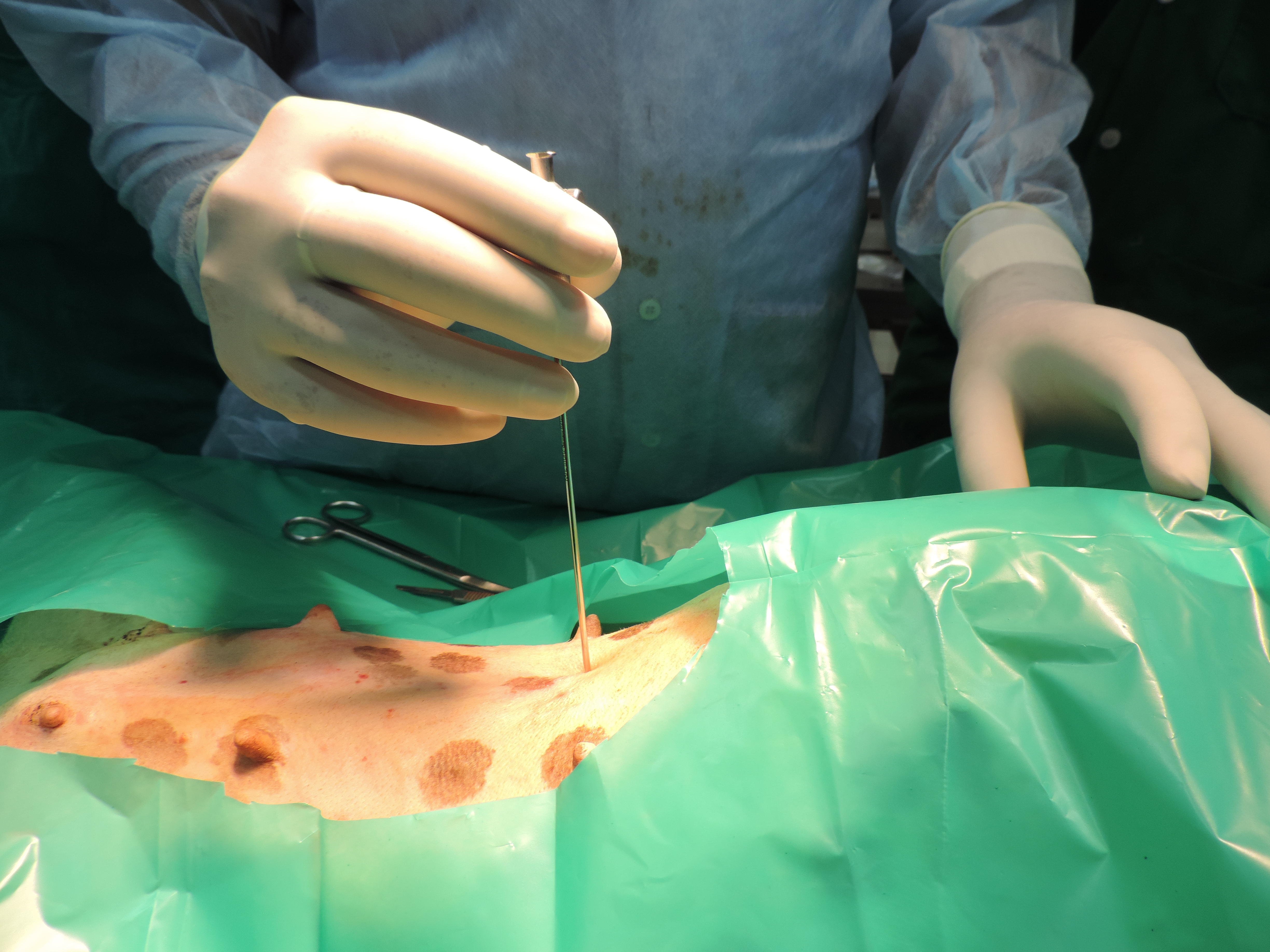 surgery-11